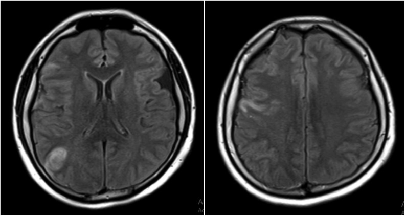 Fig. 2