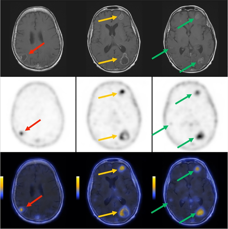 Fig. 4.