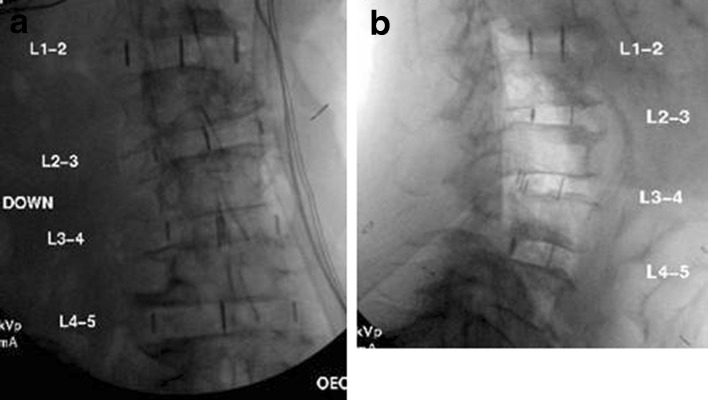 Fig. 2