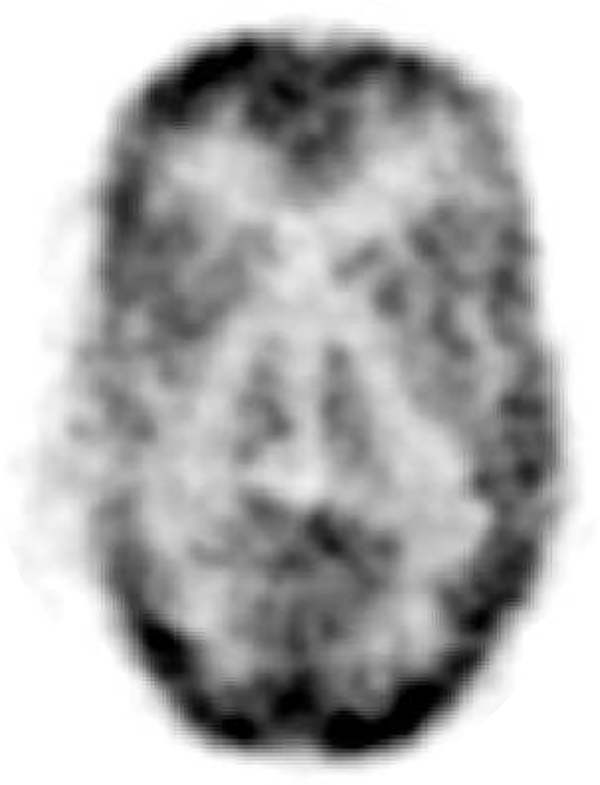 Fig. 11.