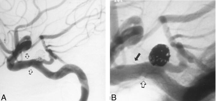 Fig 3.