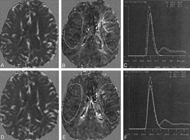 Fig 3.