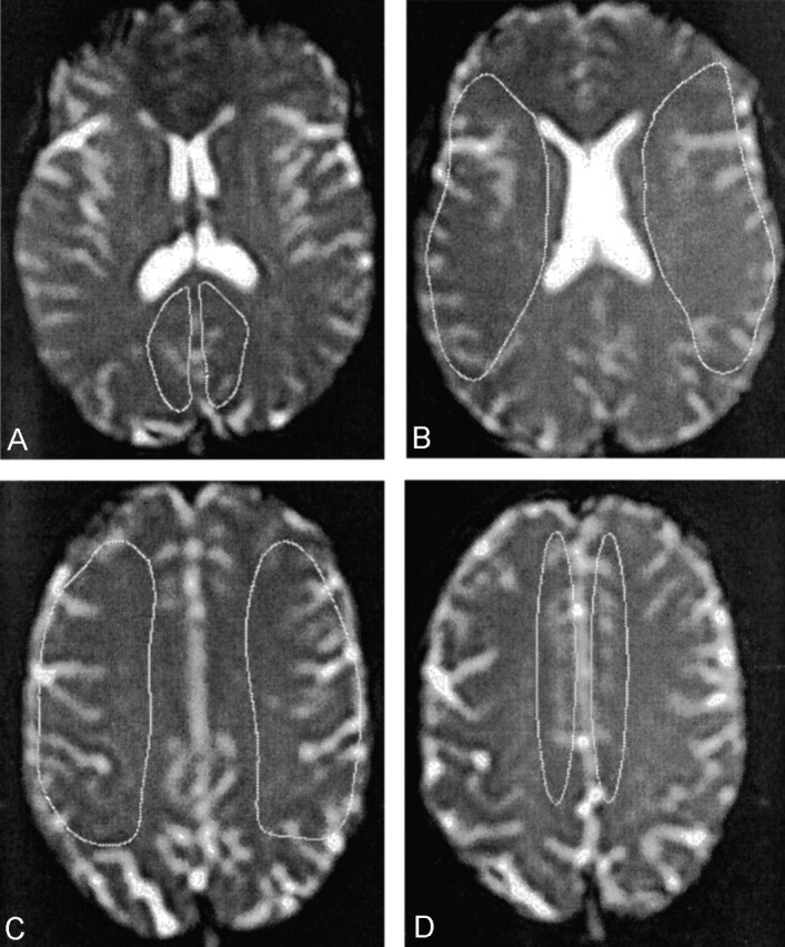 Fig 2.