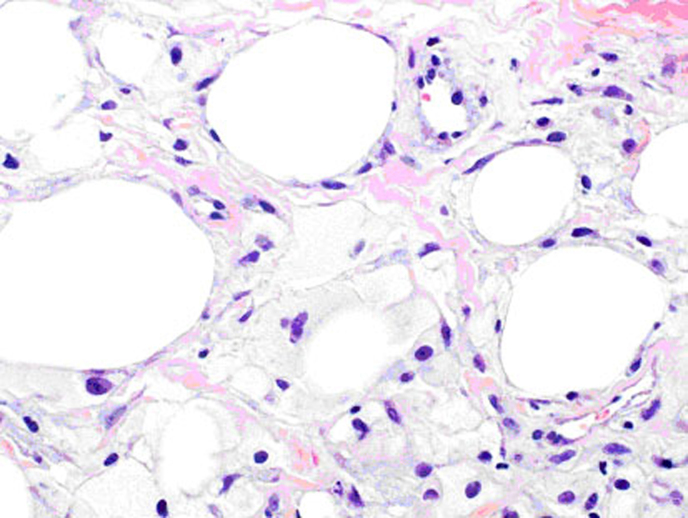 Figure 5B