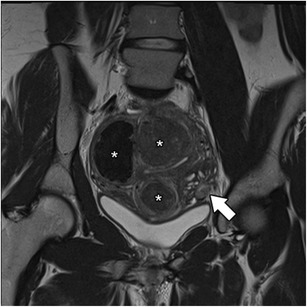 Fig. 14