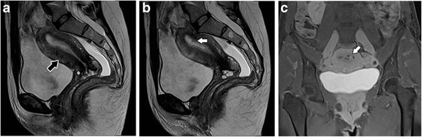 Fig. 15