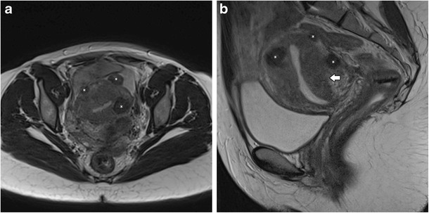 Fig. 12