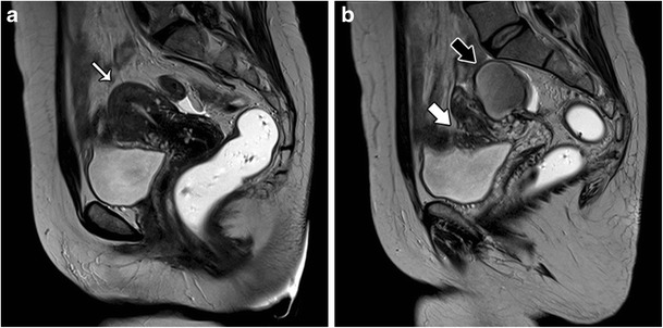 Fig. 13