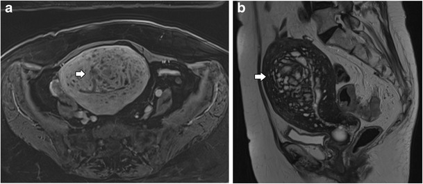 Fig. 10