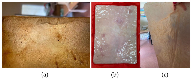 Figure 14