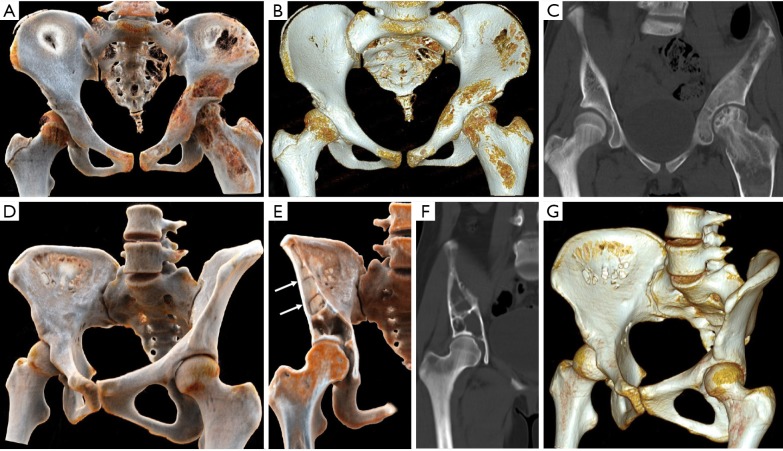 Figure 15