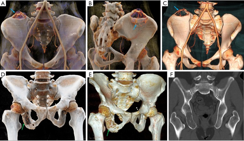 Figure 14