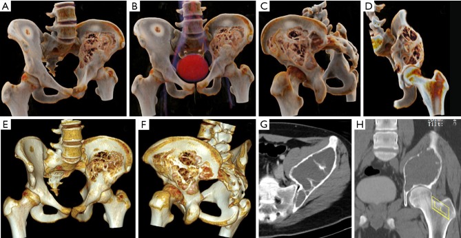 Figure 16