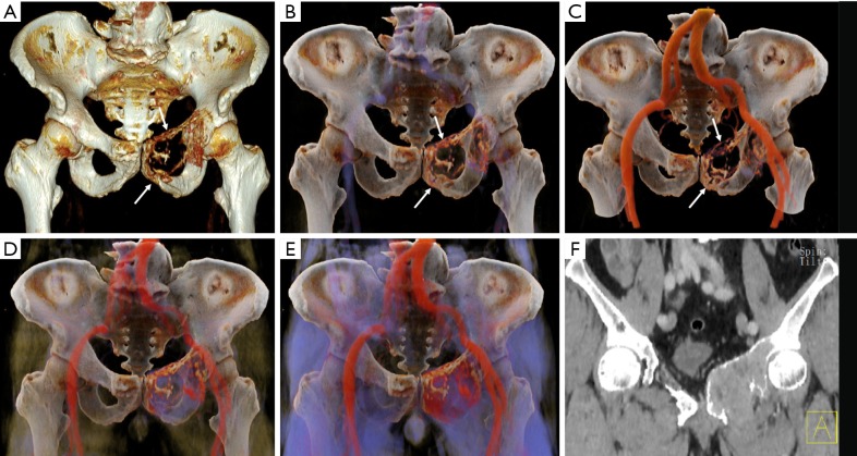 Figure 6