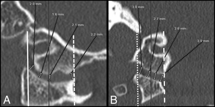 Fig 1.