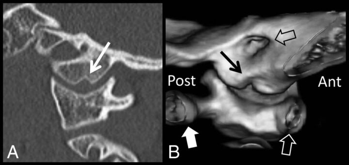 Fig 5.