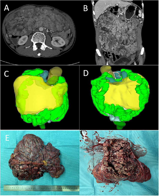 Figure 1