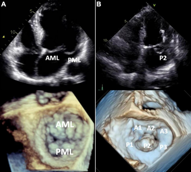 FIGURE 4