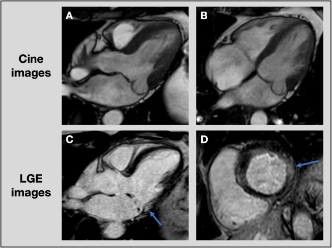 FIGURE 6