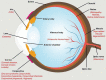 Fig. 14