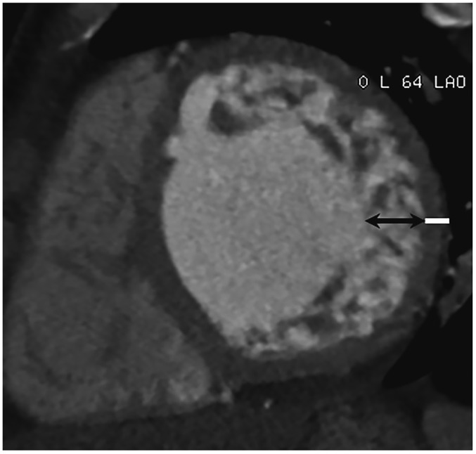 Fig. 13