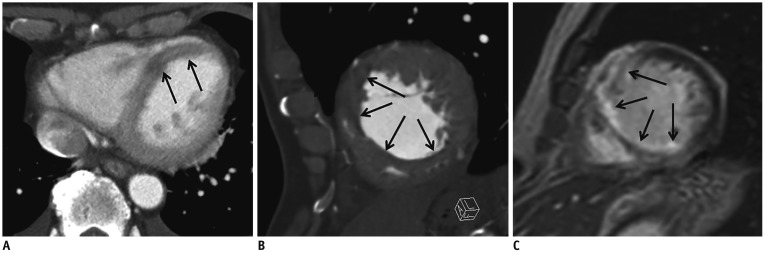 Fig. 18