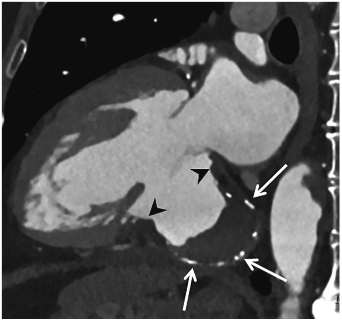 Fig. 15