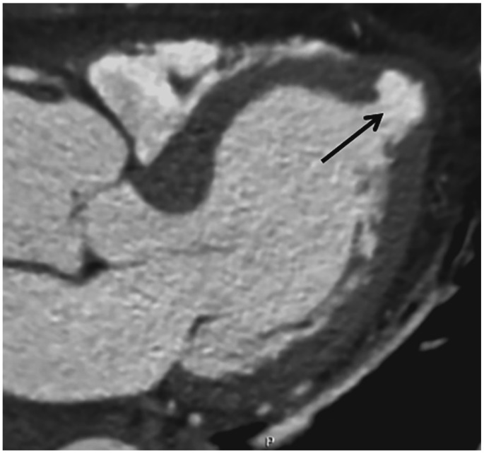 Fig. 17