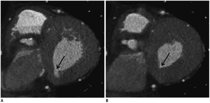 Fig. 16