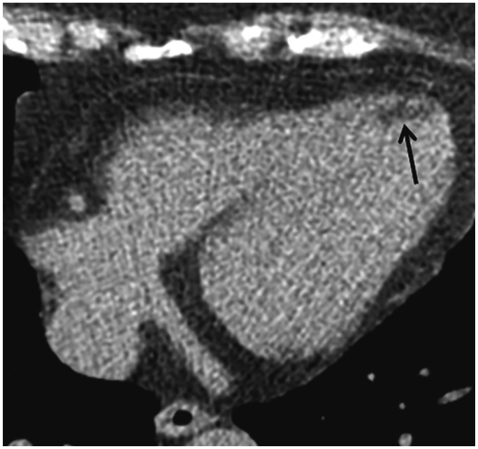 Fig. 19