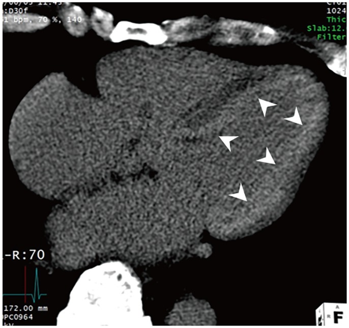 Fig. 11