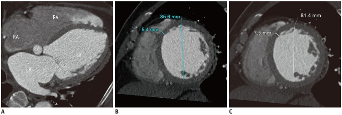 Fig. 12