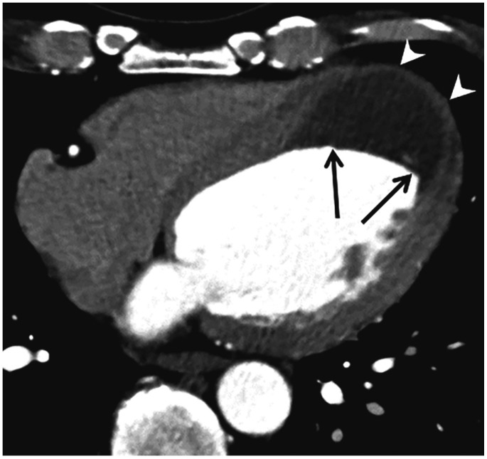 Fig. 14