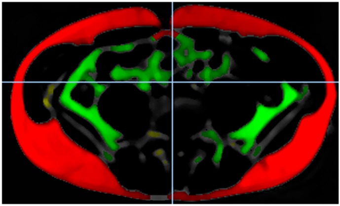 Fig 2