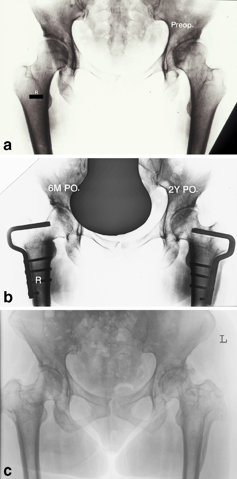 Fig 2