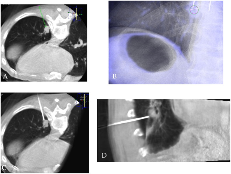 Figure 1