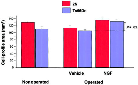 Figure  11