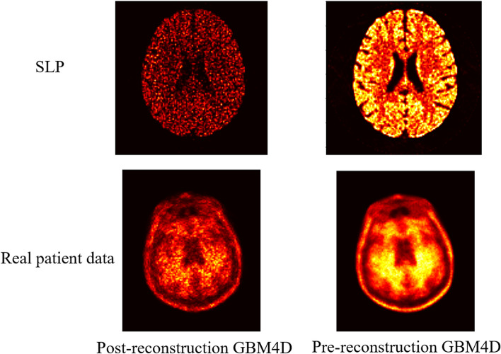 Fig. 11