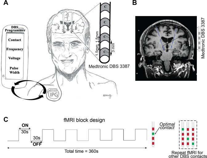 Fig. 1