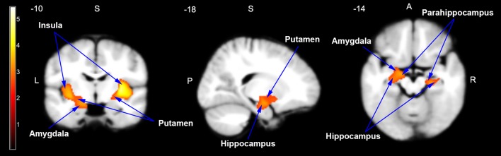 Fig. 2