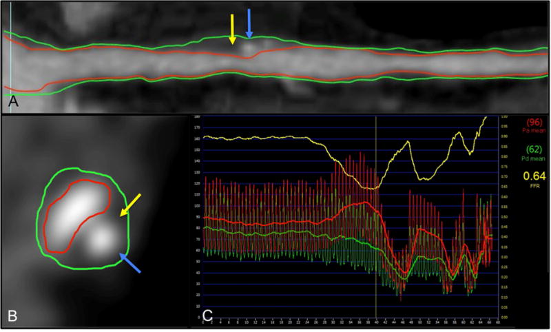 Fig. 2