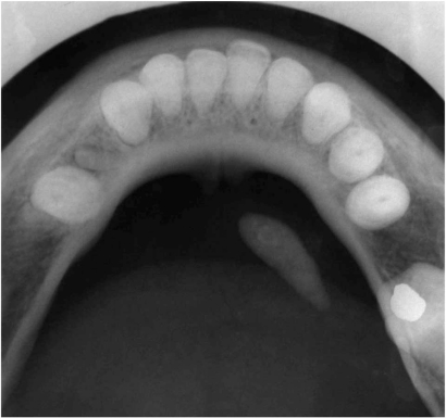 Fig. (1c)