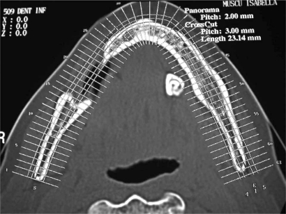 Fig. (2b)