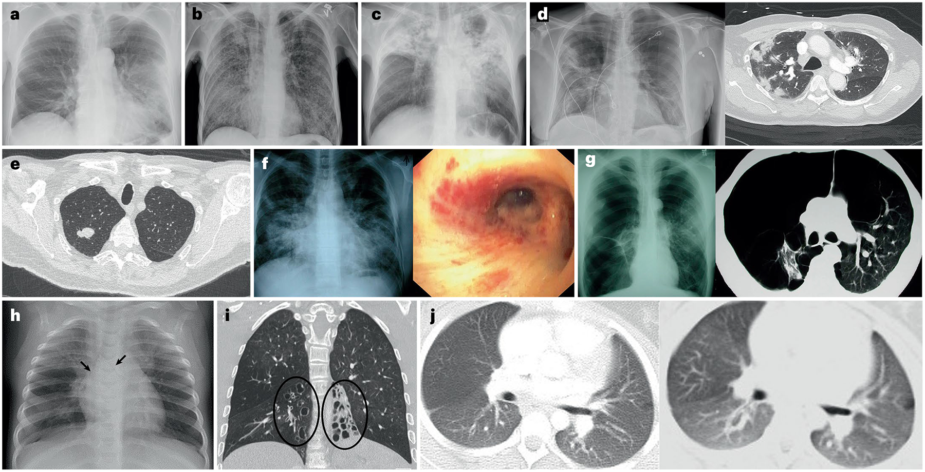 Fig. 4 |