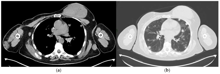 Figure 12