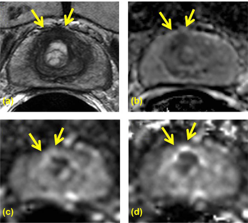 FIGURE 3: