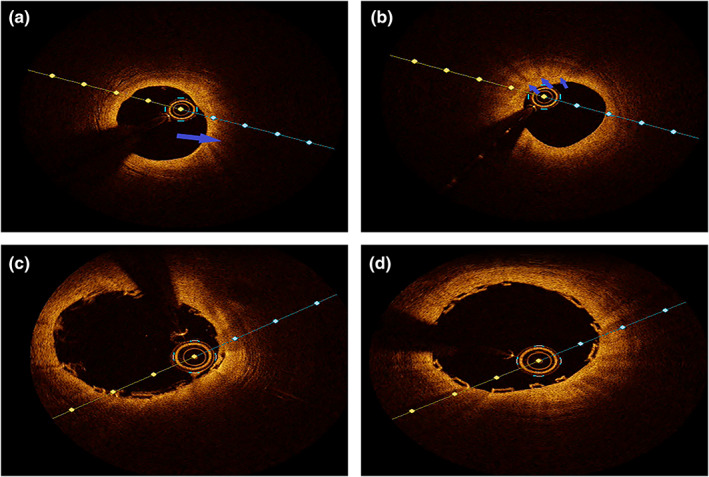 FIGURE 3