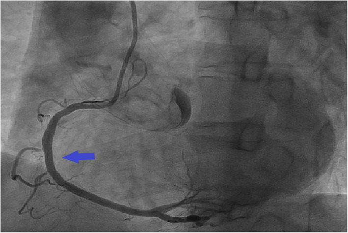 FIGURE 4