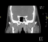 Image 2.