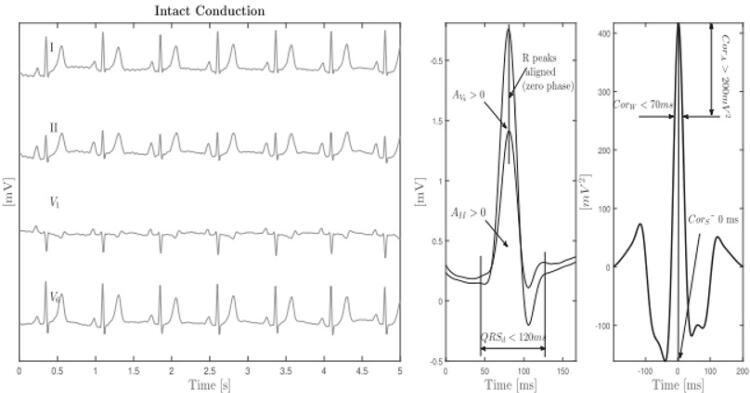 Figure 2A